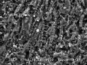 Activated Charcoal as seen at 1000x through the SEM.