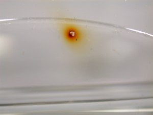 Contamination Testing - Medical Devices: Contamination identified by XPS analysis on the inside of a plastic vial for a biomedical fluid.